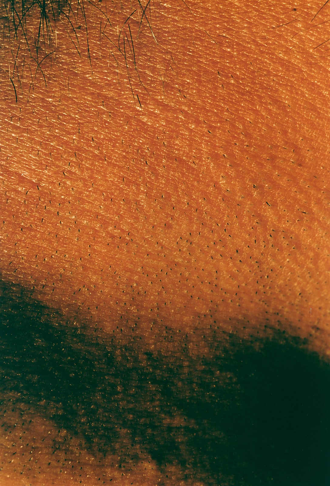 Hairy
