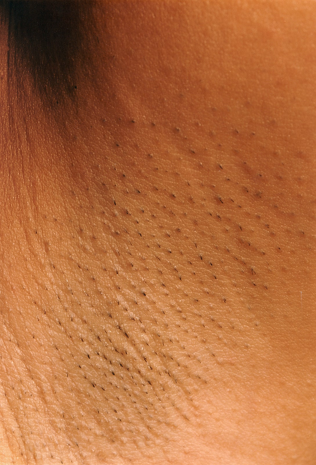 Hairy