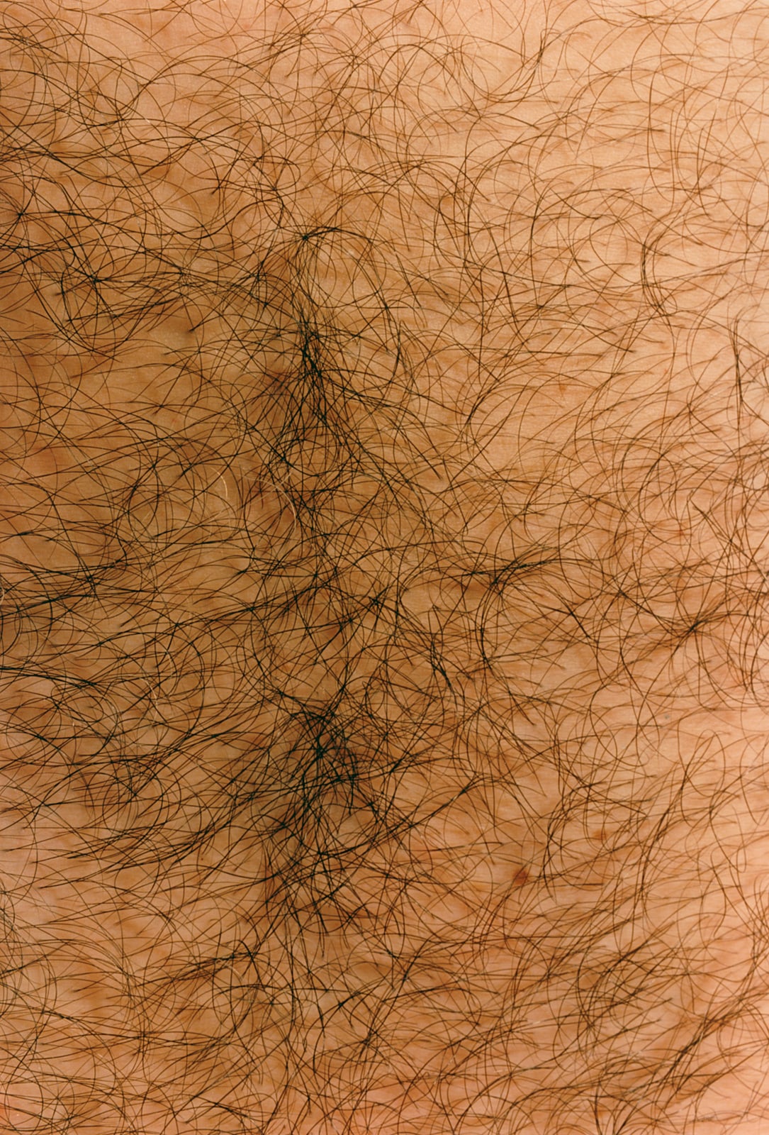 Hairy