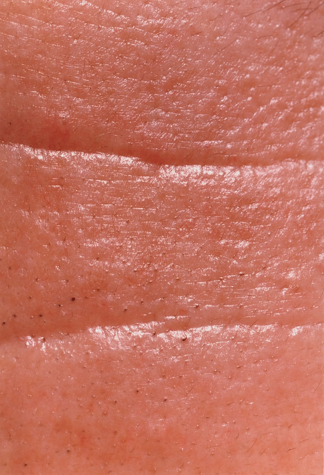 Hairy