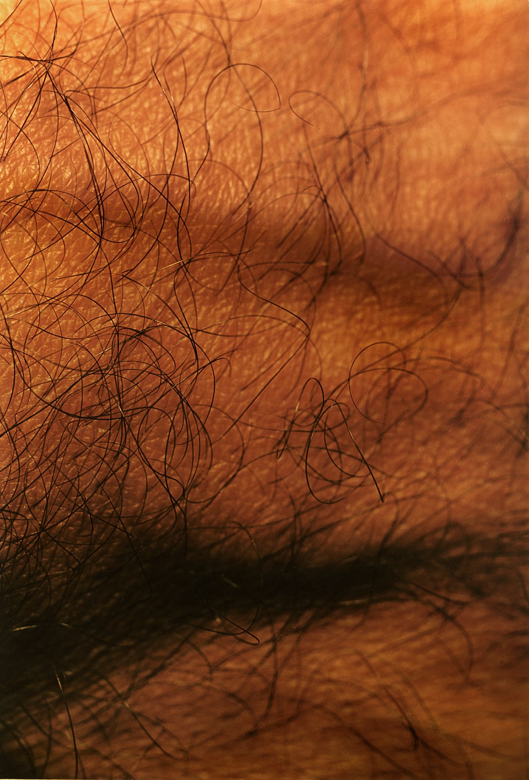 Hairy