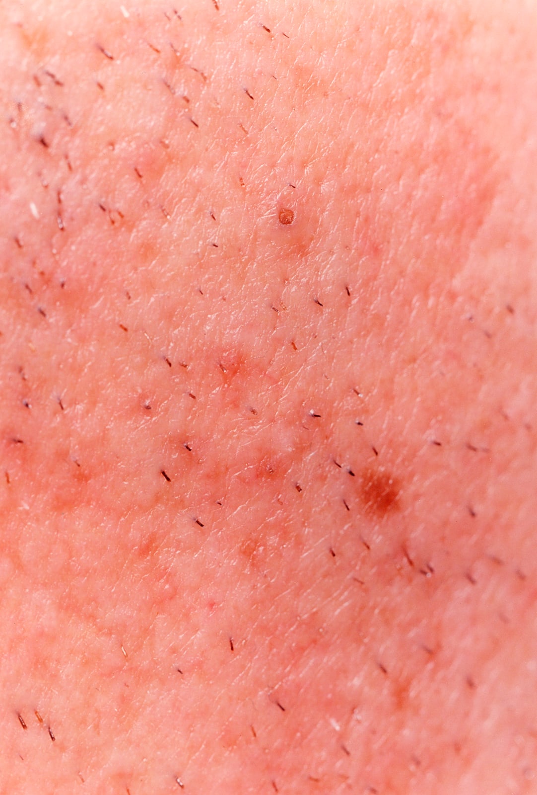 Hairy
