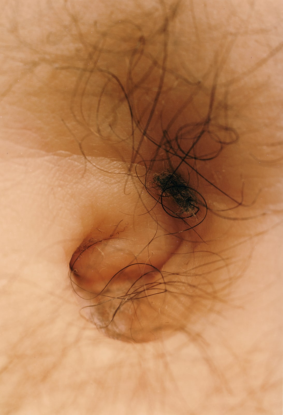 Hairy