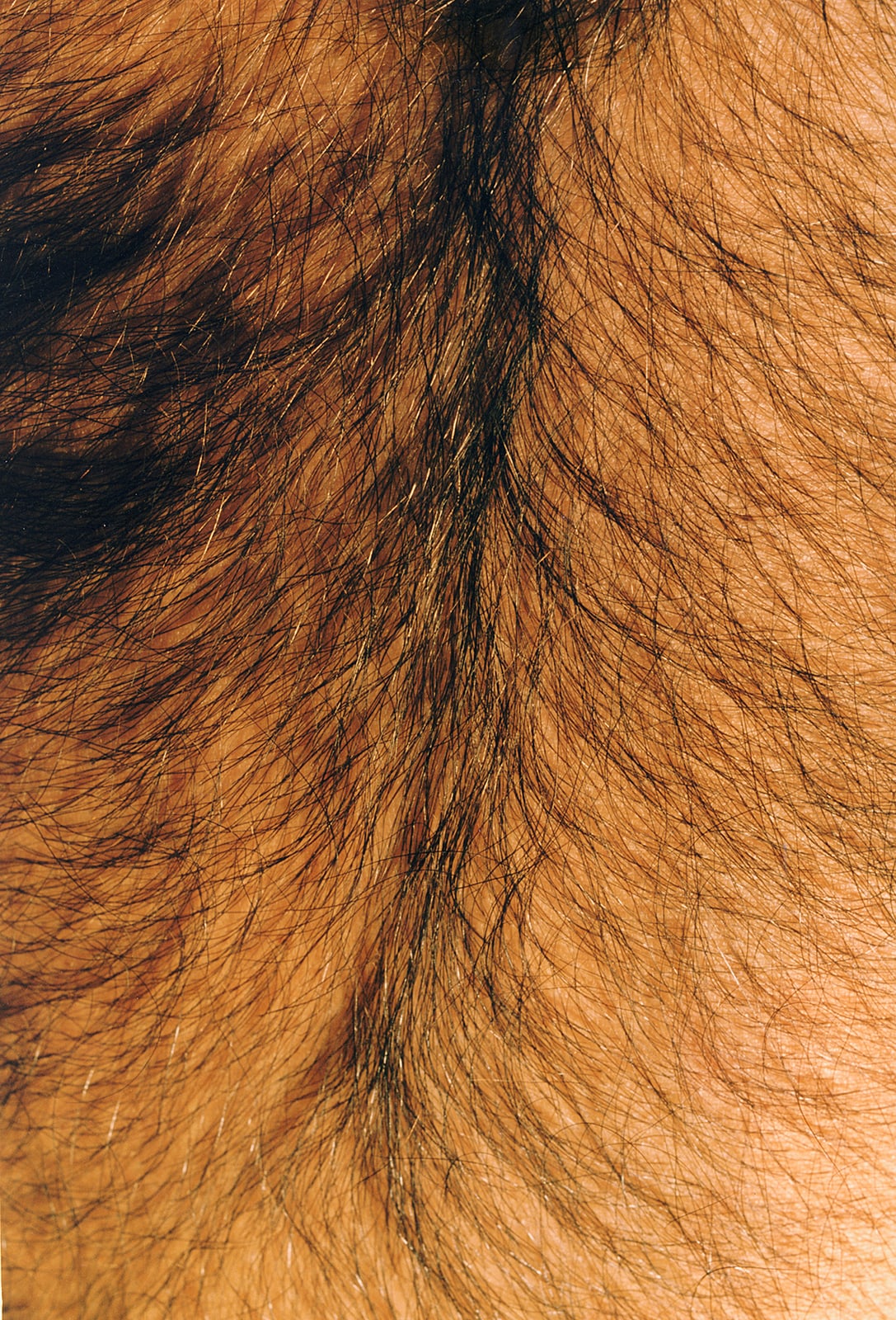 Hairy