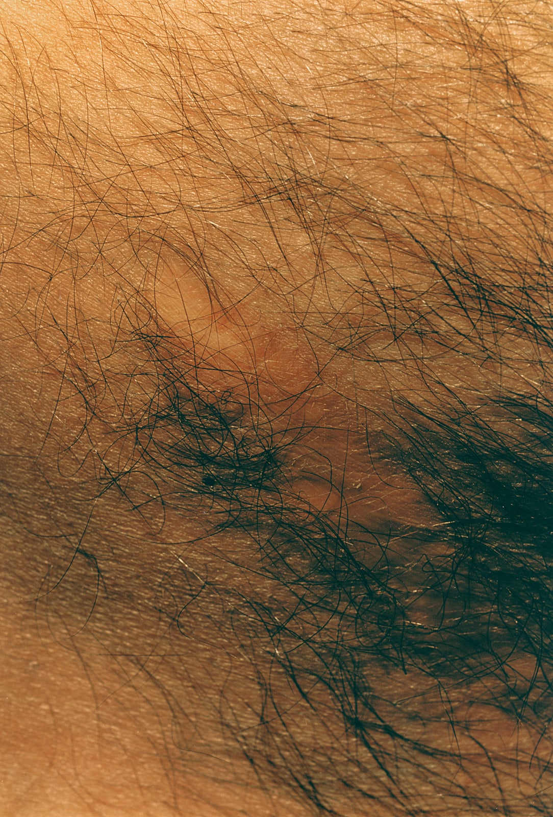 Hairy